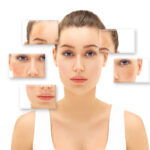 Melasma e laserterapia.