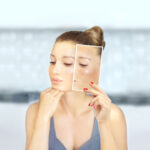 Melasma e uso de medicamentos.