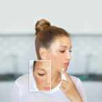 Peelings químicos para melasma: tipos e eficácia.