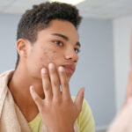 Importância do acompanhamento psicológico em casos de acne severa